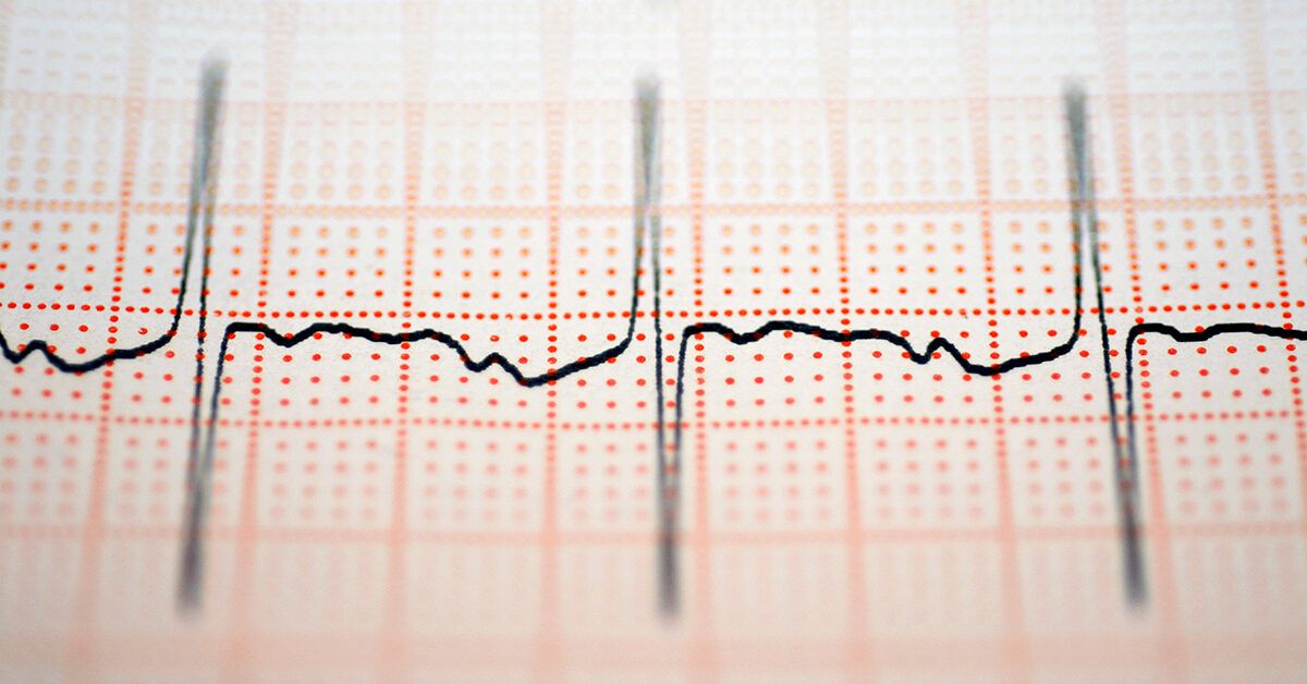 Unlocking the Secrets of Heart Rate Variability: What Your HRV Reveals About Your Health