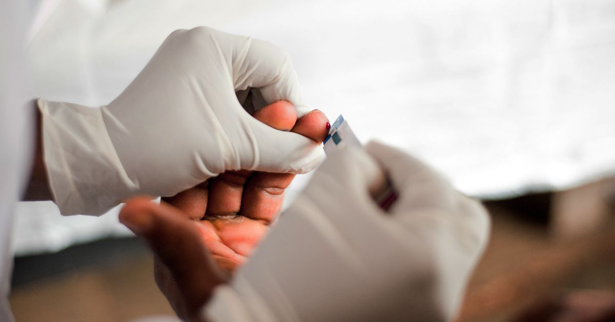 Почему серповидно-клеточная анемия может защитить от ВИЧ: новые открытия