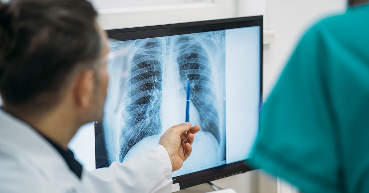 Avian Tuberculosis in Humans: Top 5 Symptoms to Watch For