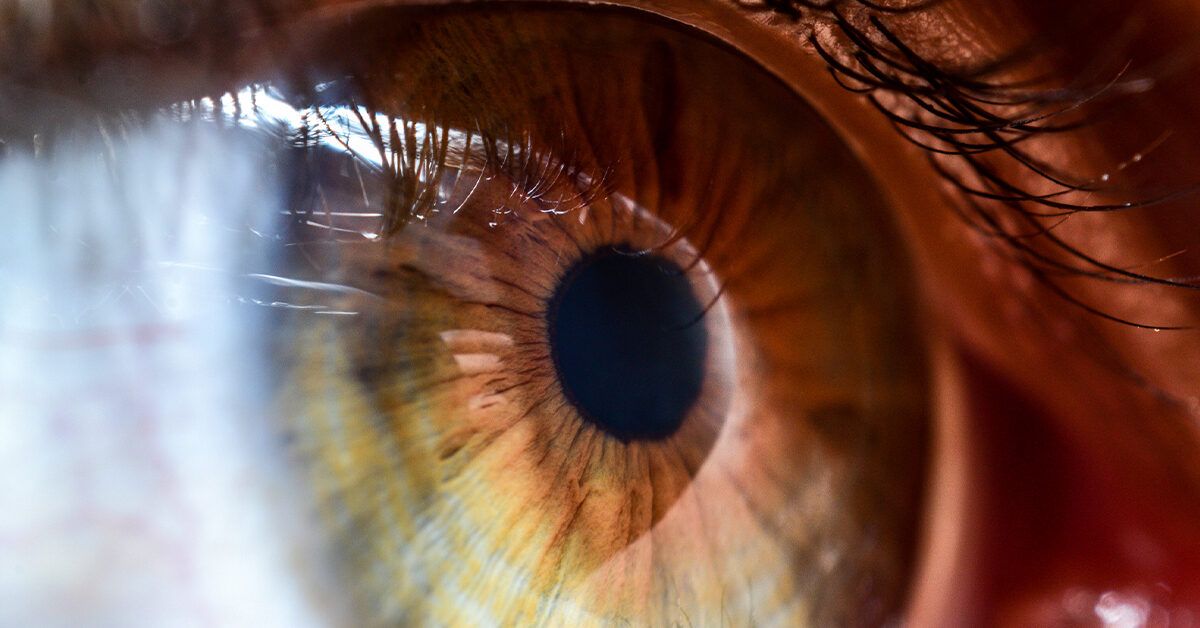Как узкий угол глаза влияет на зрение: мифы и реальность