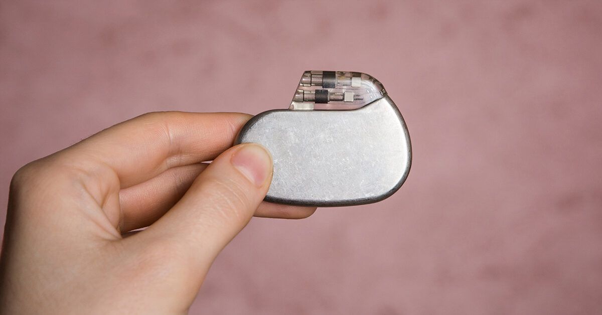 Atrial Fibrillatsiya uchun Pacesetter: Kimlarga Kerak va Nimalarga E'tibor Berish Zarur