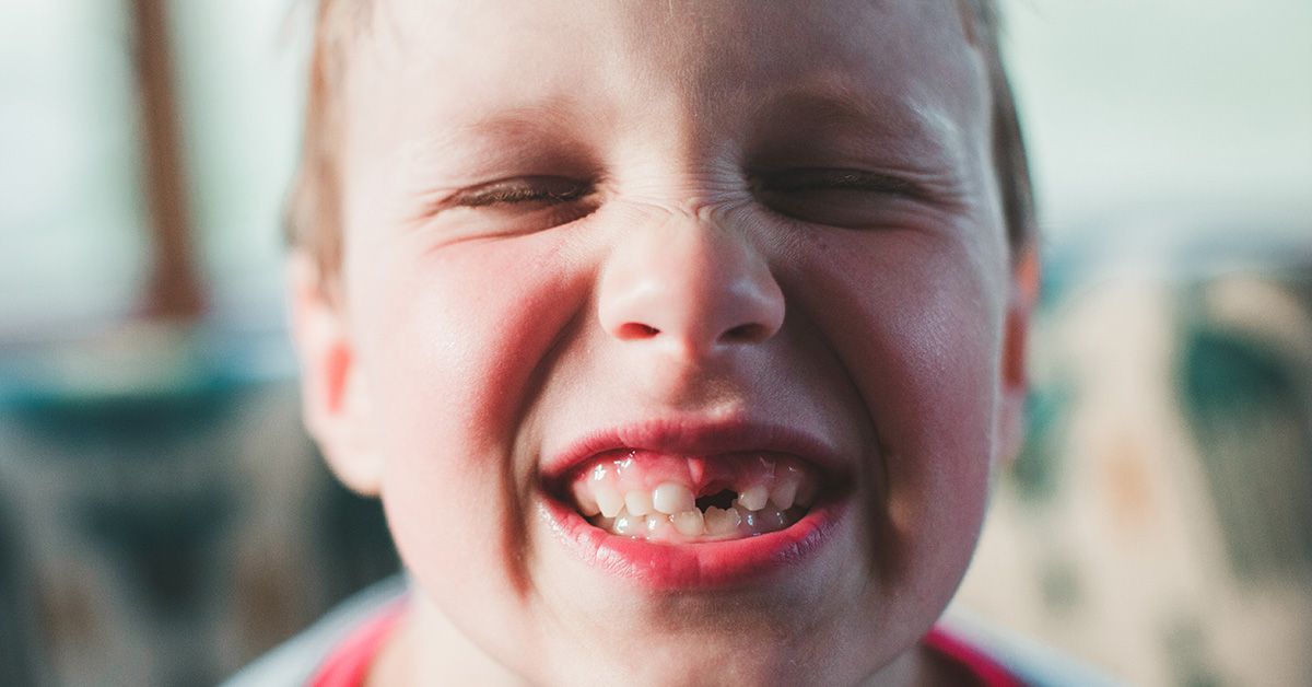 Deciduous Teeth: The Essential Guide to Baby or Primary Teeth