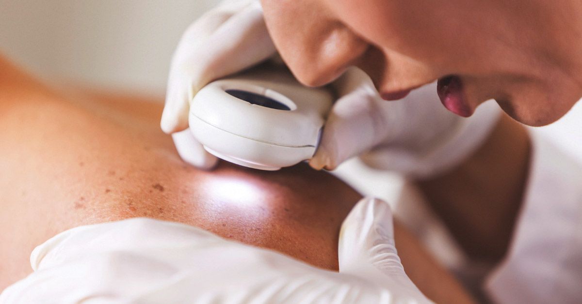 Как победить кожное воспаление: эффективные методы борьбы с зудом и раздражением