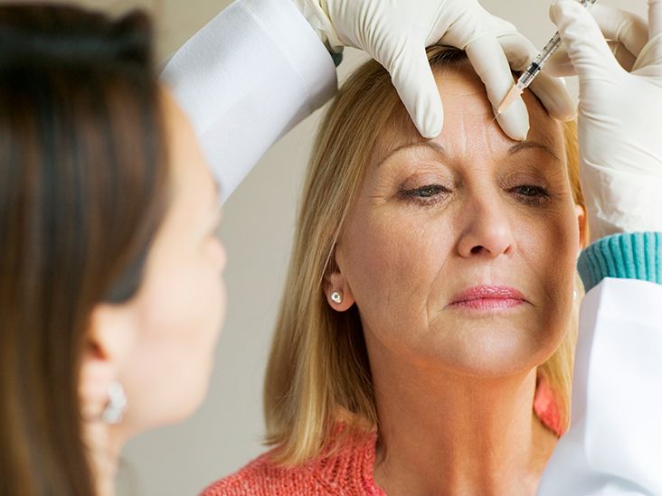 Botox for Migraine Relief: Injection Sites Explained