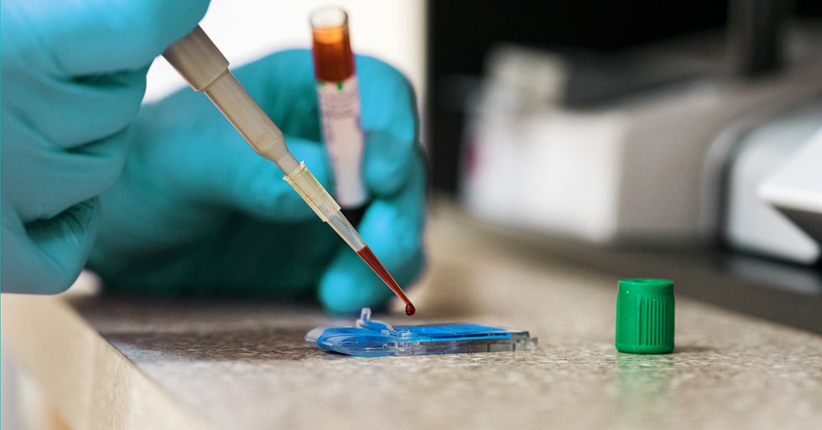 Полное исследование крови при апластической анемии: ключ к точному диагнозу