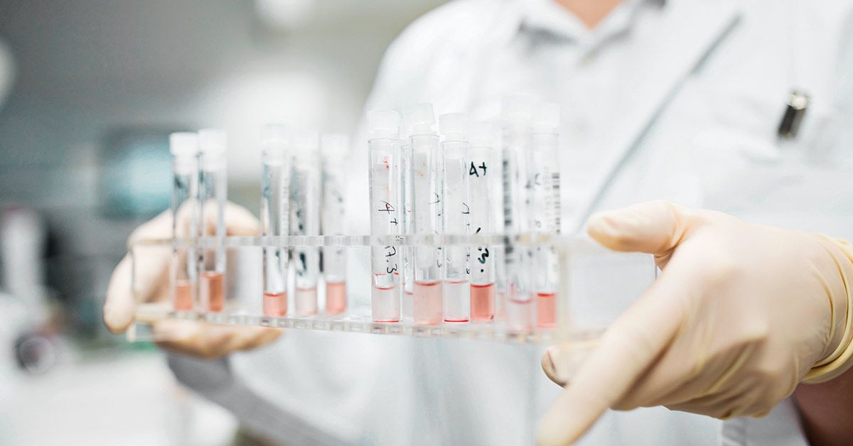 Alpha va Beta Talassemiyaning Farqlari va Belgilari