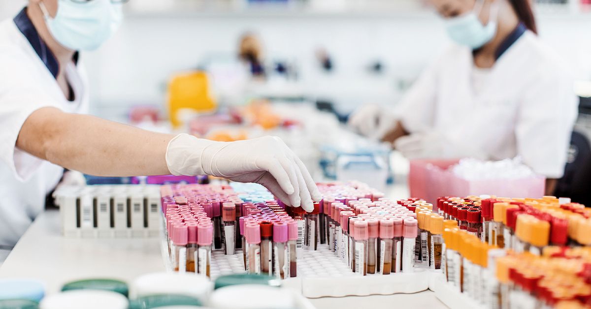 HIV-1 vs HIV-2 in 2025: Transmission, Diagnosis & Effective Treatment Costs