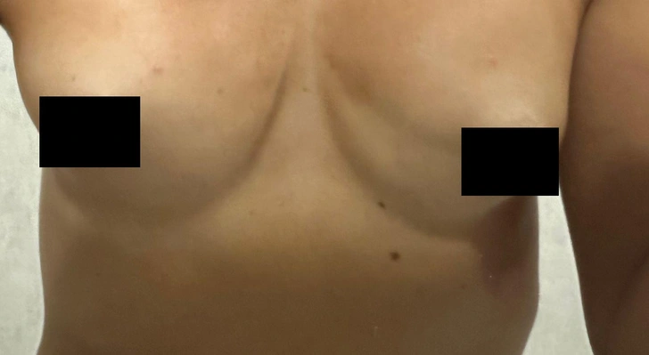 Результат после второй операции