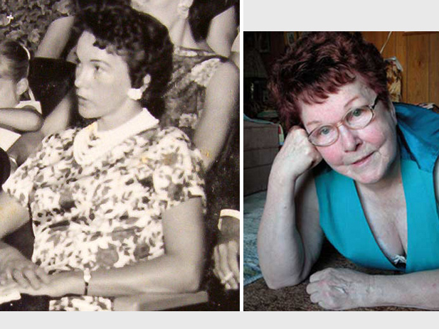 История первых силиконовых имплантов: путь женщины, изменившей мир пластической хирургии