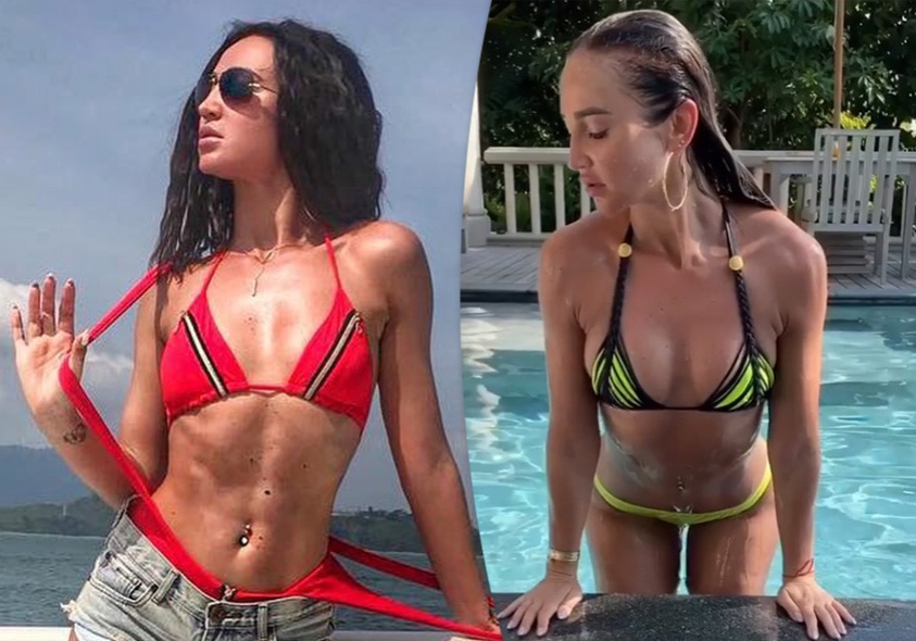 Did Olga Buzova Enhance Her Look? A Plastic Surgeon's Insight