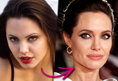 Did Angelina Jolie Undergo Rhinoplasty? Expert Plastic Surgeons Weigh In