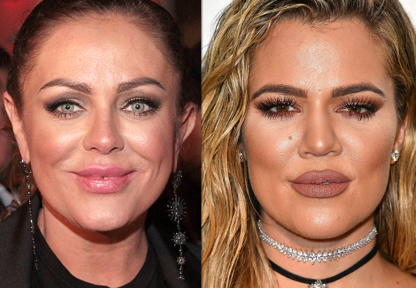 Звезды, которые переступили грань с филлерами: история о красоте и цене
