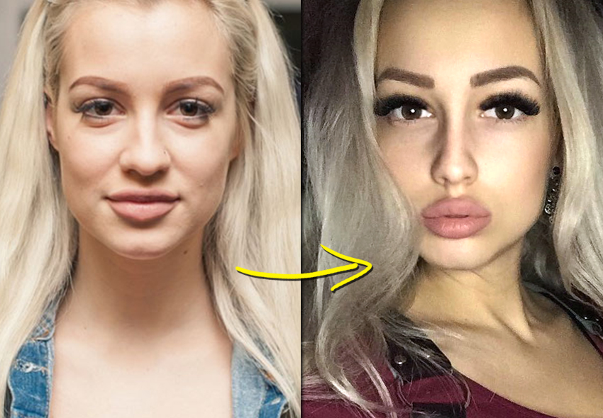 Как Екатерина Гужвинская преобразила себя после разрыва: история ринопластики