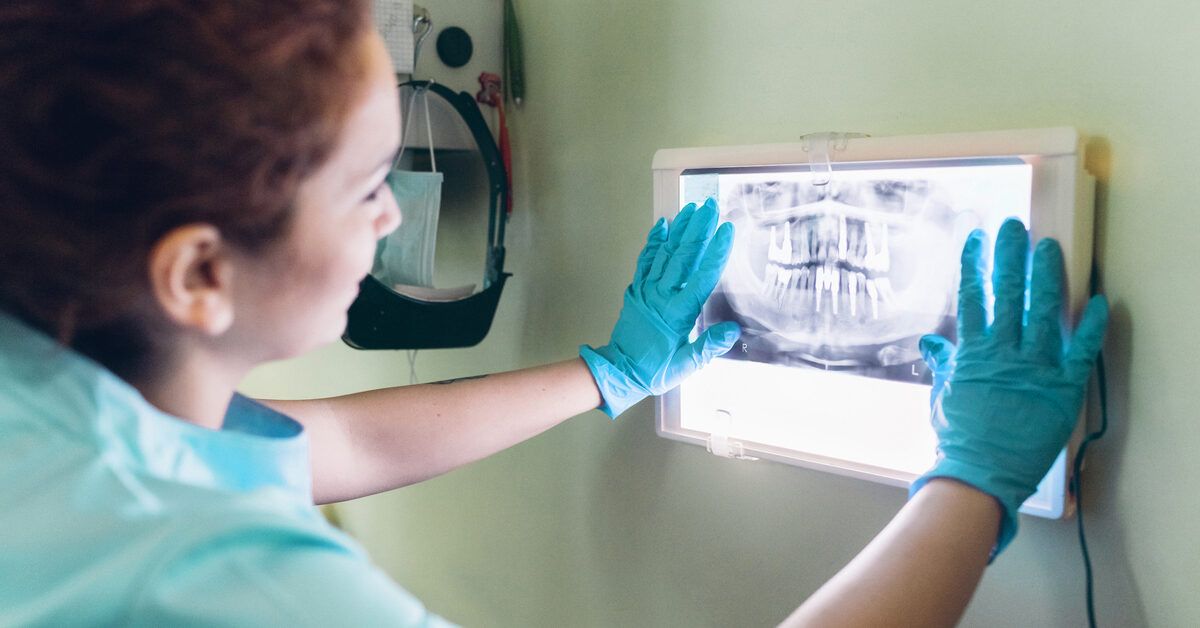 2025 Guide: How to Identify Wisdom Teeth Growth and Avoid Complications - Costs & Signs