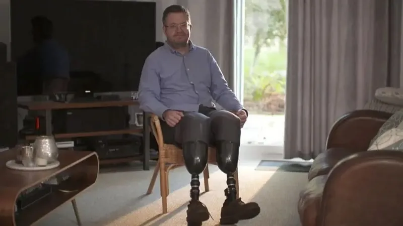 Сосудистый хирург NHS Нил Хоппер получил тюремный срок за ампутацию собственных ног и мошенничество