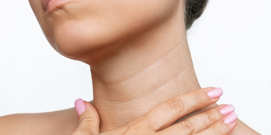 Venera halqalari Venera halqalari rasm