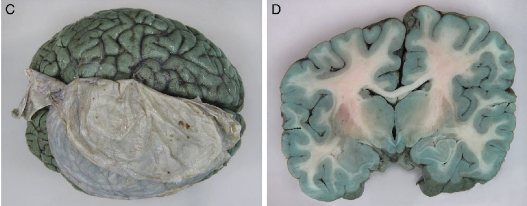 Байки биохакеров: помогает ли метиленовый синий продлить жизнь 