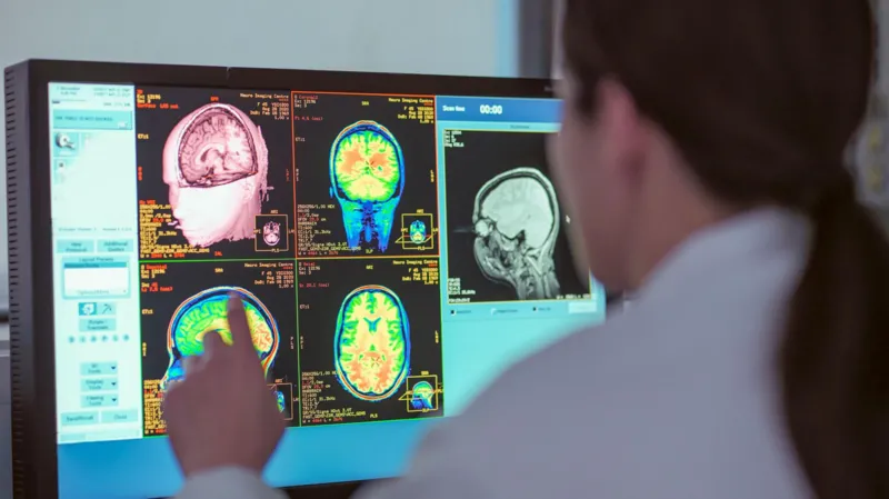 Пять возрастных фаз развития мозга: новые данные Кембриджа объясняют изменения на протяжении жизни